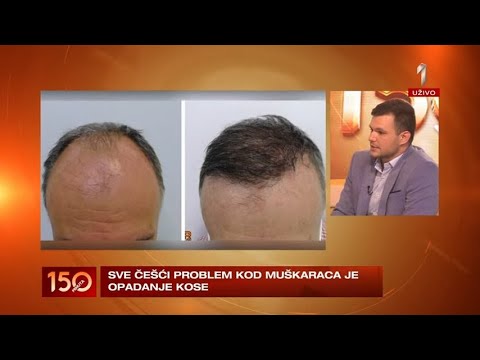 Video: Da li šišanje kose smanjuje opadanje kose?