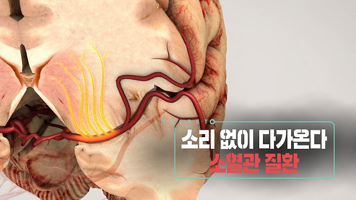 📌방송 하이라이트📌소리없이 다가온다 소혈관 질환 (KBS 20230308 방송)
