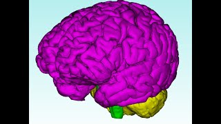 Coreform Cubit: automatic hex meshing for biological and material sciences
