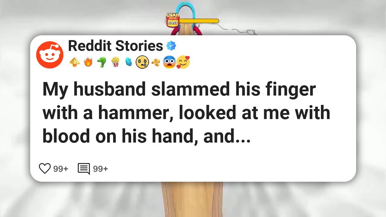 My husband slammed his finger with a hammer, looked at me with b***d on his hand, and #reddit 