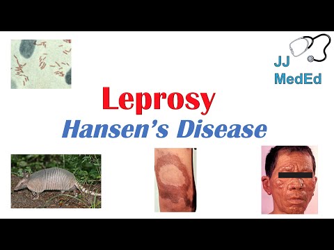 वीडियो: कुष्ठ रोग को हैनसेन रोग क्यों कहा जाता है?