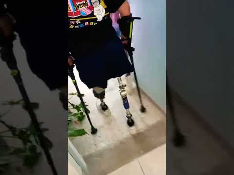 bilateral #amputee gait