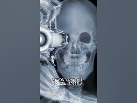 Отличие КТ от МРТ - YouTube