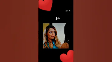 ابطال مسلسل رائحة الفراولة قبل وبعد ديميت أوزديمير çilekkokusu 