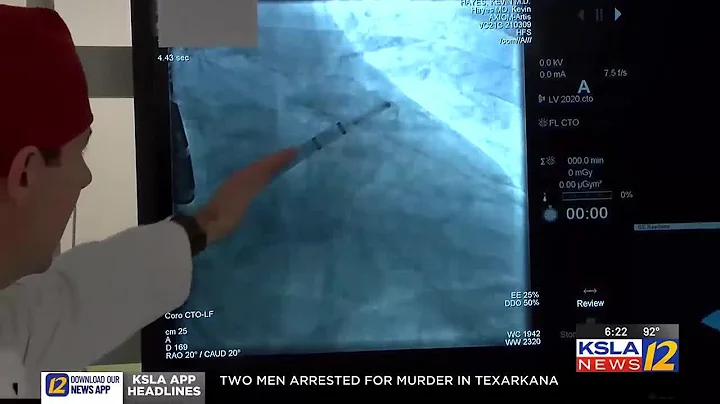 New Watchman procedure at CHRISTUS St. Michael Health aims to reduce stroke risk