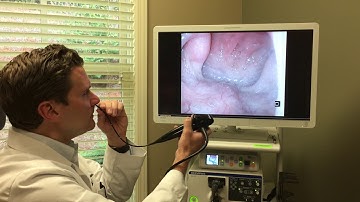 ENT flexible laryngoscopy