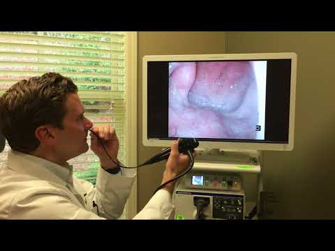 ENT flexible laryngoscopy