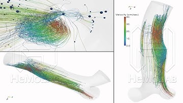 Blood flow - Particle tracing