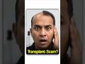 Why Hair Transplants Fail (Even After Spending ₹2 Lakhs 😳)