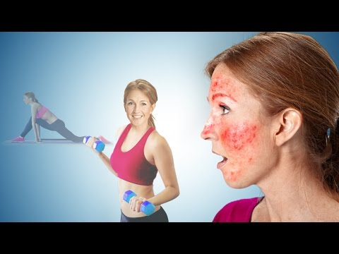 Why Does the Face Flush or Turn Red While Exercising