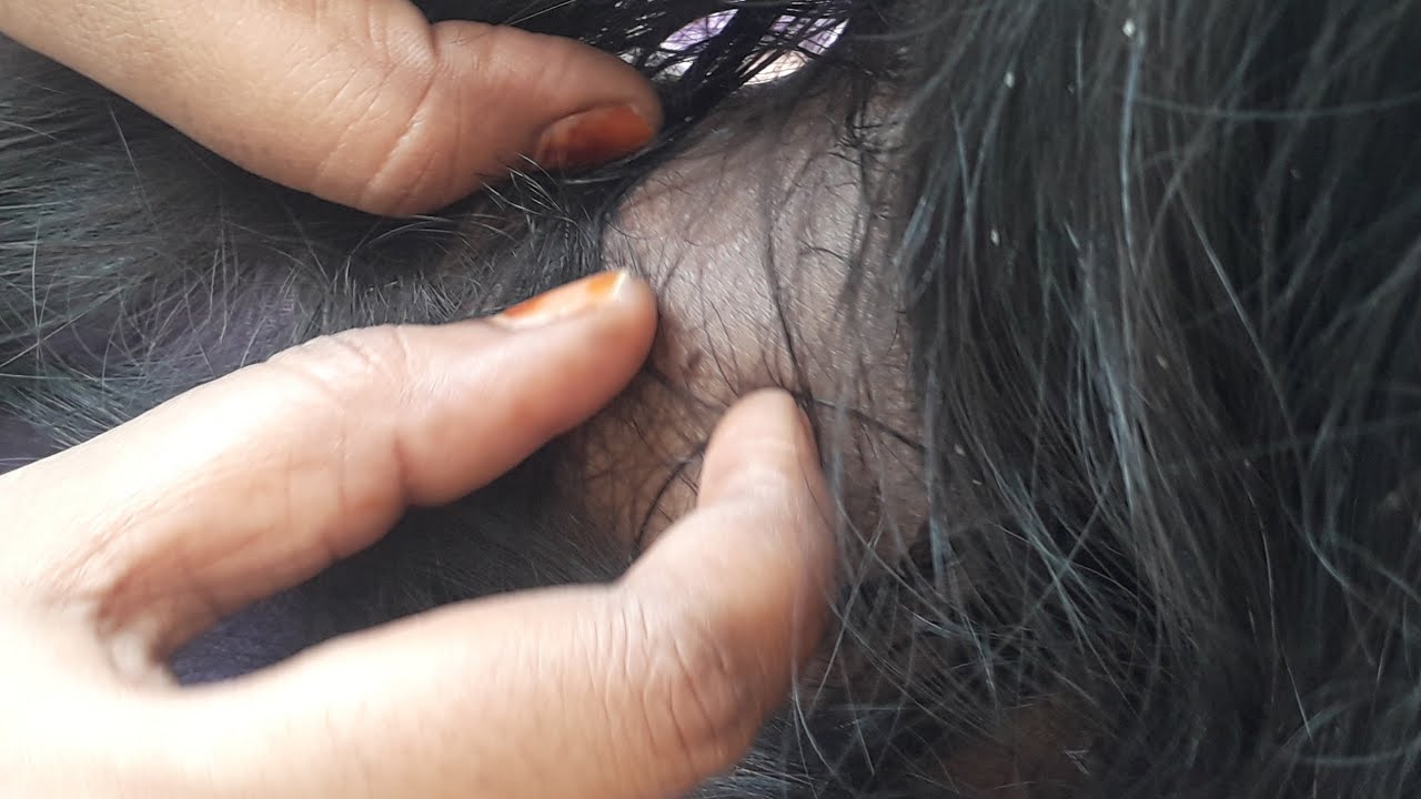 silky black hair Nitpicking with her mother hands/real sounds in telugu @PR Nitpicking channel