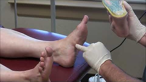 Painful Plantar Fibromas in Feet