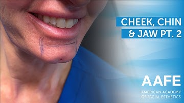 Cheek, Chin & Jaw Pt. 2