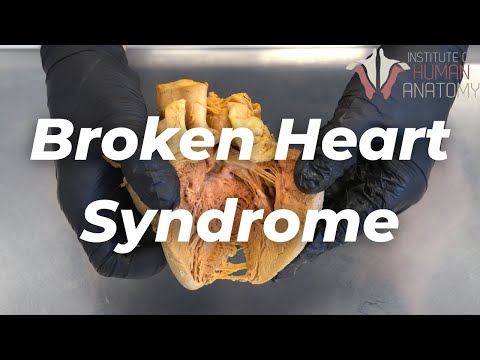 Video: A Break Up. Death By A Broken Heart