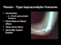 Pediatric Supracondylar Fractures by Dr Todd Mason