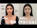 眉下切開 二重切開 鼻フルしたラストコールの売女(ウリーニョ)達が決まってニューハーフ顔に収束していく理由