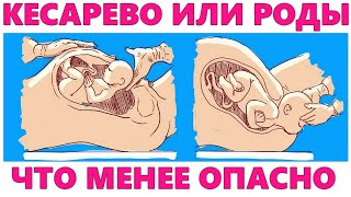 КЕСАРЕВО СЕЧЕНИЕ | Шесть самых популярных мифов о кесаревом сечении