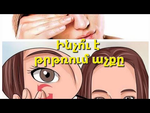 Video: Ինչպիսի՞ տեսք ունի լուքը: Լսերի տեսակները՝ նկարագրություն, լուսանկար