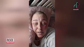 Mom Who Used TikTok to Chronicle Cancer Dies at 37