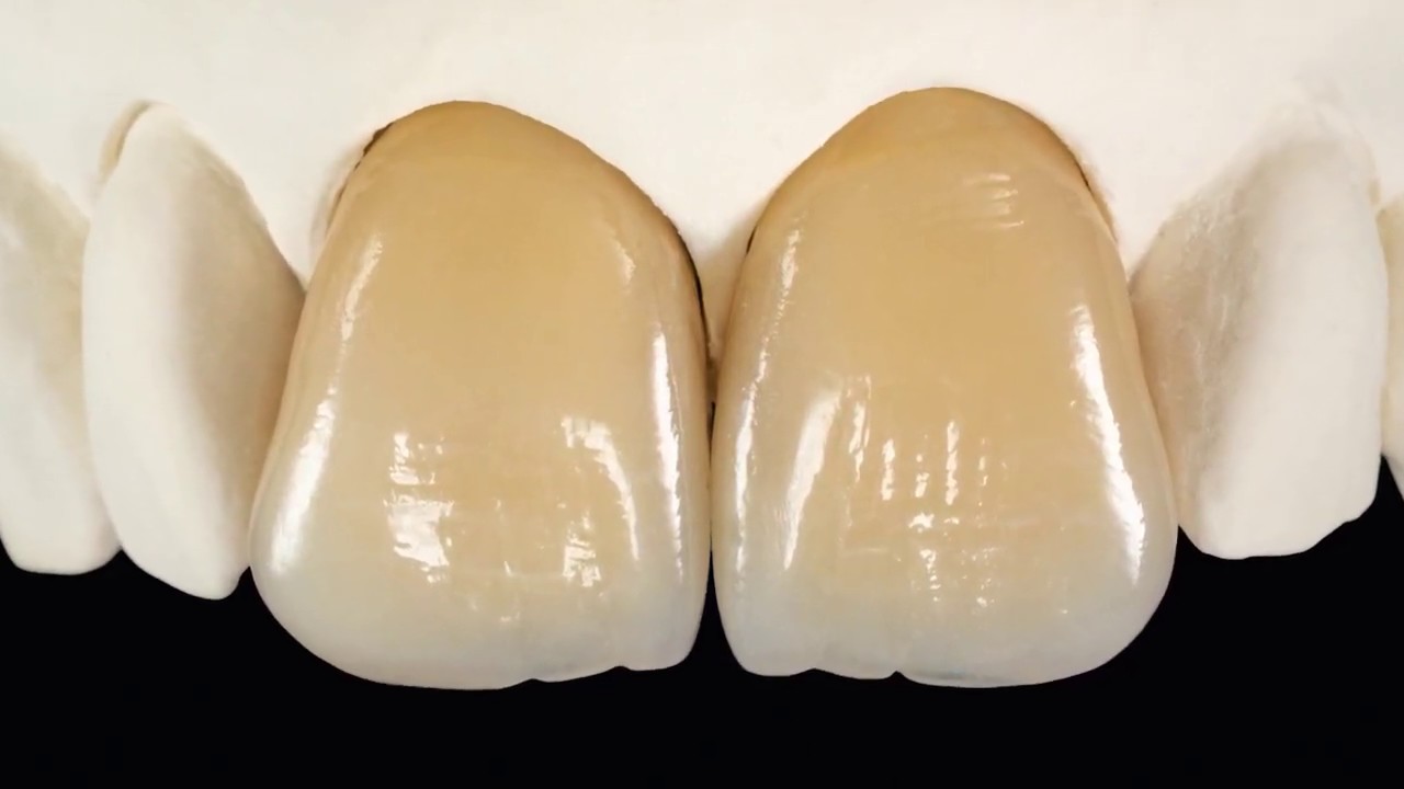 Tutorial – HeraCeram Saphir aplicación personalizada