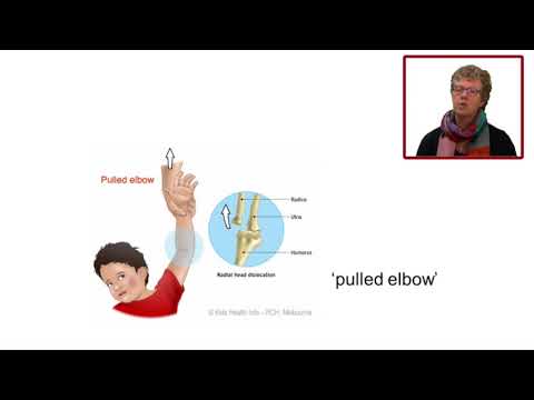 Video: Elleboogbeenderen Anatomie, Diagram En Functie - Lichaamskaarten