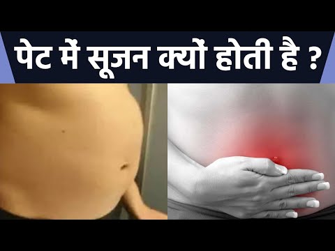 पेट में सूजन क्यों होती है ? | Pet Me Sujan Kyu Hoti Hai ? | Boldsky