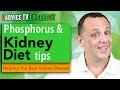 Phosphorus and kidney disease diet high phosphorus foods and renal diet tips