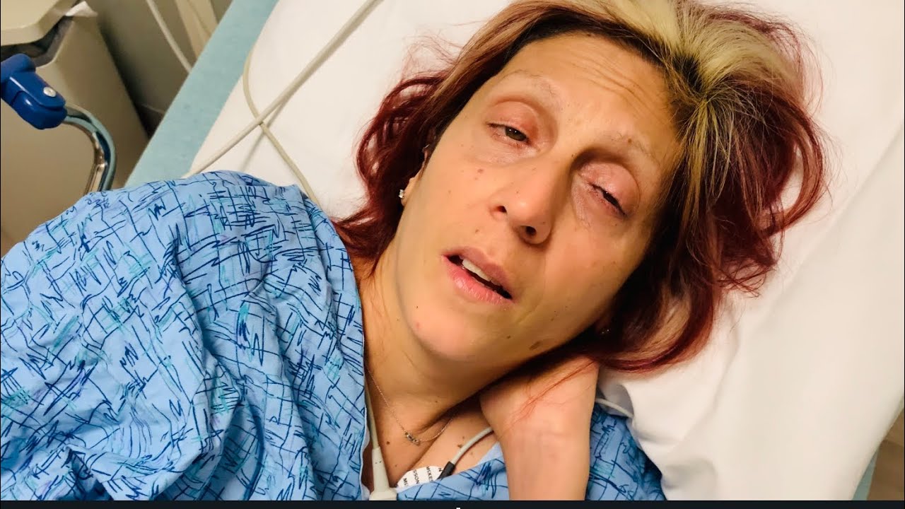 Rachael S Words After Anesthesia Ed Recovery Youtube