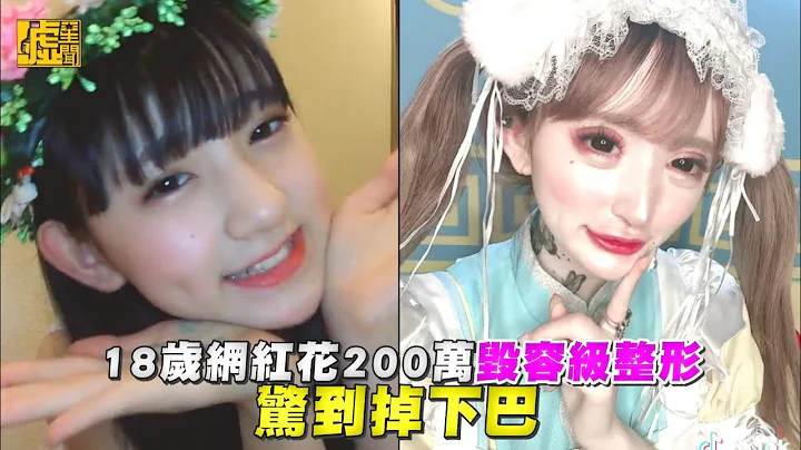18歲網紅花200萬毀容級整形 驚到掉下巴 - 天天要聞