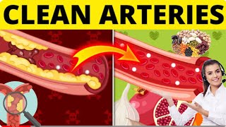 top 7 foods that unclog arteries naturally and prevent heart attack