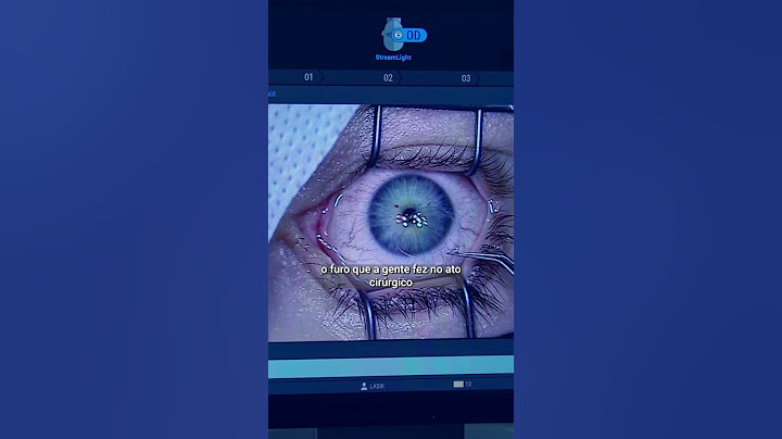 Como é a cirurgia do Glaucoma?