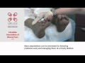 Canadian Association Of Wound Care Foot Care Video Diabetes Healthy Feet And You Canadian Association Of Wound Care Foot Care Video Diabetes Healthy Feet And You
