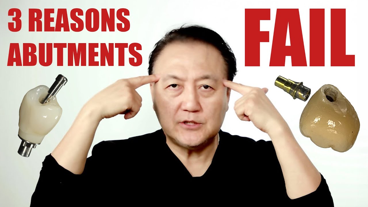 Избегайте этих 3 распространенных ошибок при установке имплантационных абатментов.