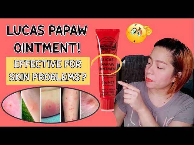 Treat bites with Lucas' Papaw ointment - What She Just Said