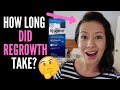 WHAT TO EXPECT WHEN STARTING ROGAINE OR MINOXIDIL, HOW LONG DOES IT TAKE TO WORK (And Weddings Talk)