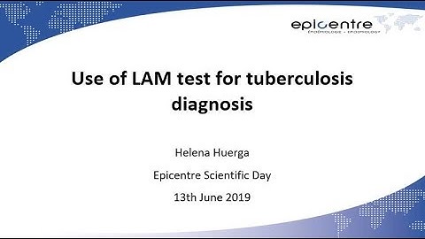 Use of LAM test for tuberculosis diagnosis – Helena H (EN)