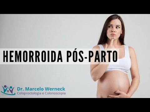 Vídeo: Tratamento De Hemorróidas Pós-parto Com Amamentação: Meios, Comentários