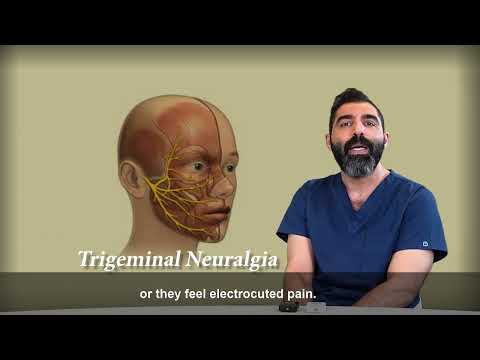 دردهای عصب سه قلو یا نورالژی تری ژمینال  