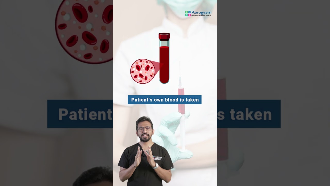 Benefits of PRP for Early Osteoarthritis