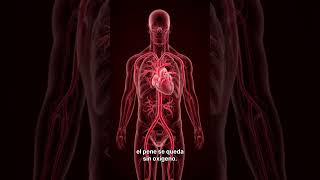 Priapismo  Emergencia Médica Dra  Reyes#Priapismo