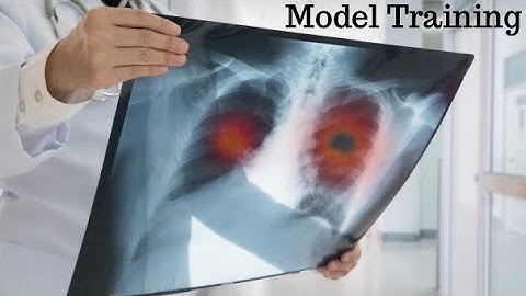 COVID-19 Chest X-RAY Detection using Deep Learning - Model Training Part 5
