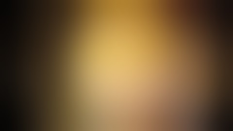 HUGE SIGMOID POLYP , ENDOLOOP ASSISTED POLYPECTOMY 