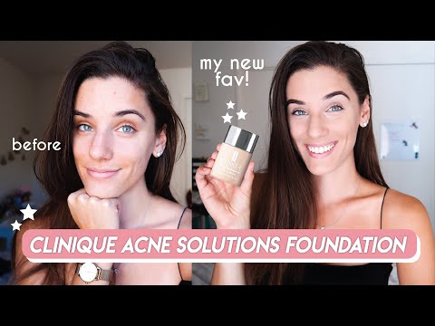 Natural Looking Foundation for Acne? | CLINIQUE ACNE SOLUTIONS FOUNDATION REVIEW + DEMO