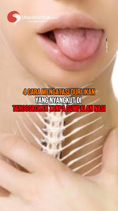 4 Cara Mengatasi Duri Ikan yang Nyangkut Di Tenggorokan Tanpa Gumpalan Nasi#shorts#tenggorokan#duri