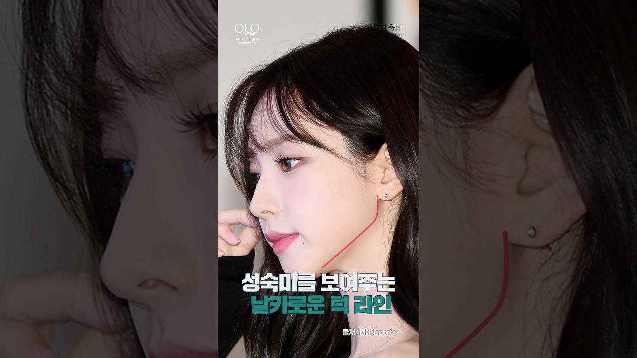 [奧洛整形外科診所] 整形外科專科醫師 艾斯帕 '卡琳娜' 臉部分析！ | 全承培院長