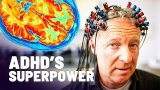 Do YOU Have ADHD? The Hidden Signs You Might Be Missing