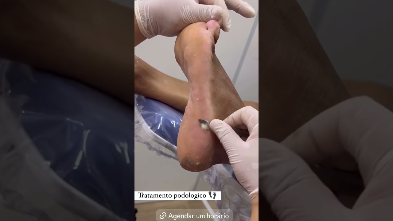 Podologia em Sion BH: Saúde e Cuidado no Ceros Beauty Studio