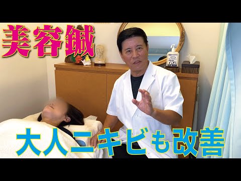 美容鍼 ニキビは鍼で改善できる！自宅でできるセルフケアもご紹介！動画サムネイル