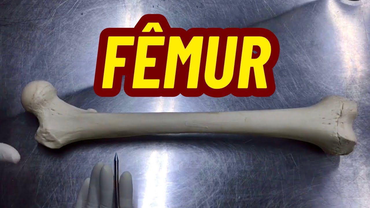 ACIDENTES ÓSSEOS DO FÊMUR