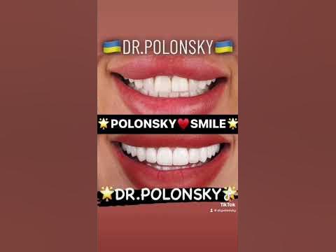 Виниры Одесса Стоматология Доктор Полонский Одеса Стоматологія Одеса # ...